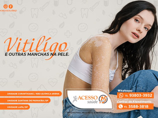 Saiba o que são Manchas na Pele e Vitiligo