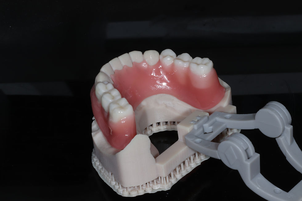 Thumbnail: Flexible Partial Denture