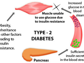 Case Study #3: Diabetes & Vision Issues