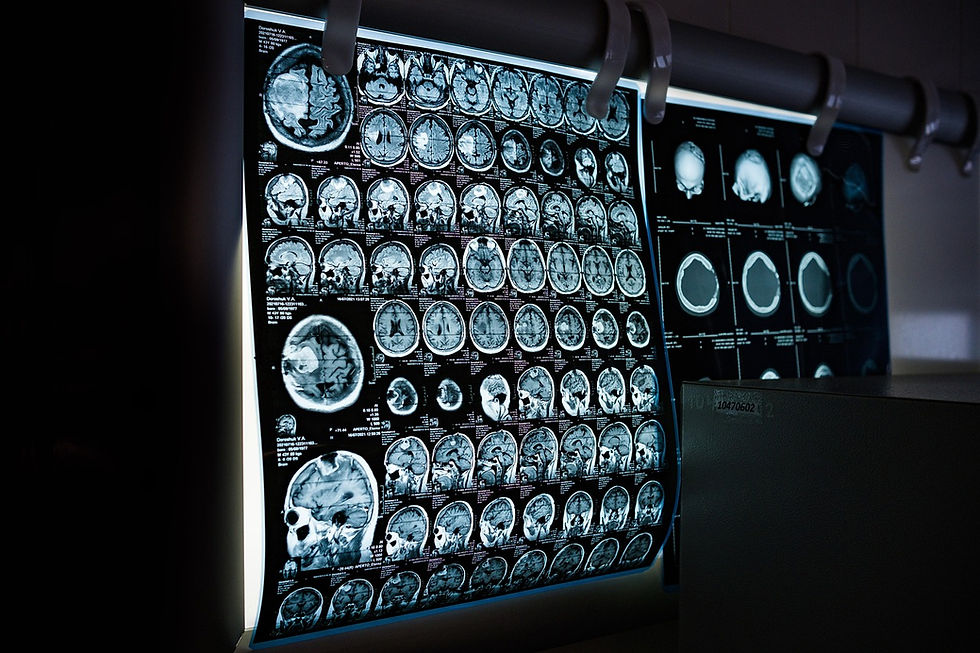 Brain MRIs on display.