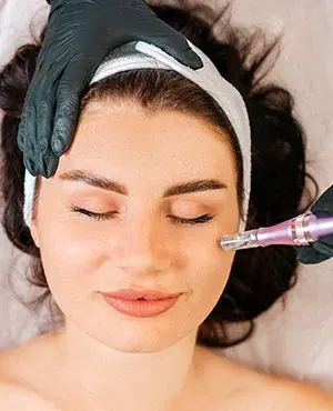 How Many RF Microneedling Sessions Do You Really Require?
