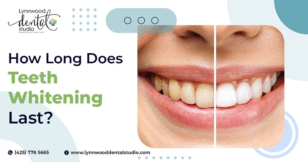 How Long Does Teeth Whitening Last