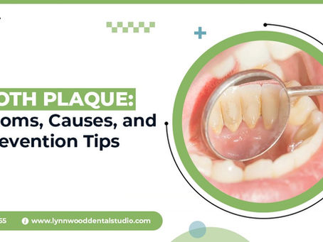 What Causes Plaque on Teeth - Explained by a Dentist