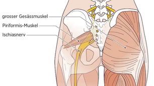 Piriformis-Syndrom: Ursache, Symptome und Behandlung | schmerzcenter.com