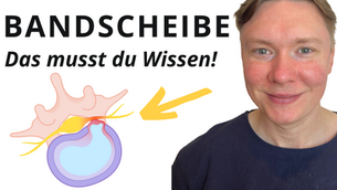 Verständnis der Bandscheiben: Mythos und Wahrheit