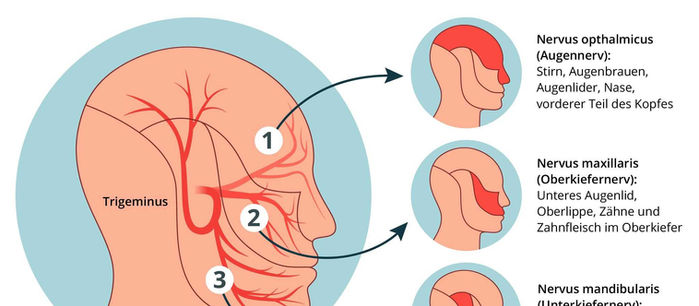 Trigeminusneuralgie: Ursachen, Symptome und Diagnostik | schmerzcenter.com