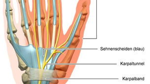 Karpaltunnelsyndrom: Ursachen, Symptome und Diagnostik | schmerzcenter.com