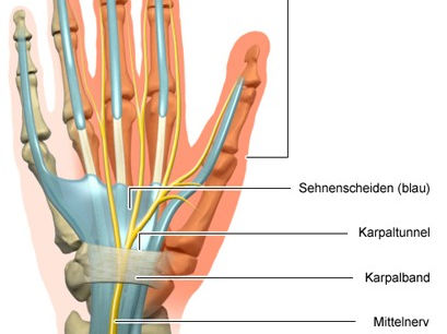 Karpaltunnelsyndrom: Ursachen, Symptome und Diagnostik | schmerzcenter.com