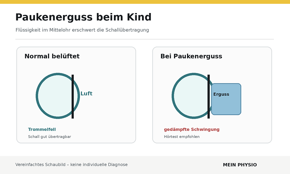 Paukenerguss – schematische Darstellung, Mein Physio