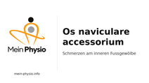 Os naviculare accessorium: Schmerzen an der Fussinnenseite erkennen und behandeln