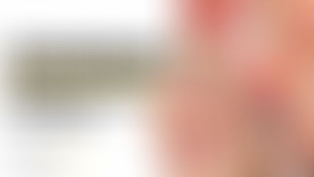 Leistenbruch: medizinische 3D-Anatomie der Bauchwand und Leistenregion mit vorgewölbtem Bruchsack