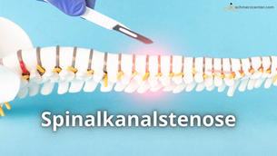 Spinalkanalstenose: Ursache, Symptome und Behandlung | schmerzcenter.com