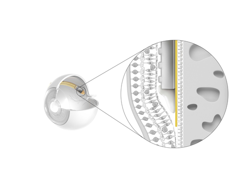 Implante de Retina Alpha IMS