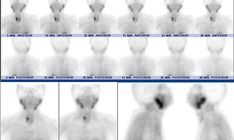 INA Scan-PARATIROIDES.jpg