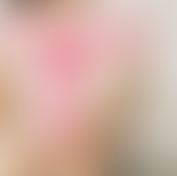 Endométriose : découvrez son impact sur le quotidien et la sexualité, et comment la sexothérapie et l’accompagnement peuvent aider à mieux vivre.