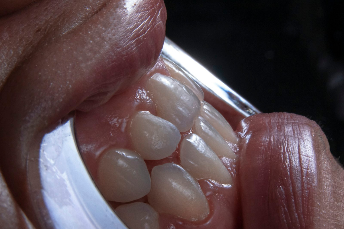 Primo piano dei denti