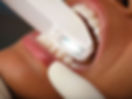 Invisalign aligners made using digital impressions for comfortable orthodontic care.