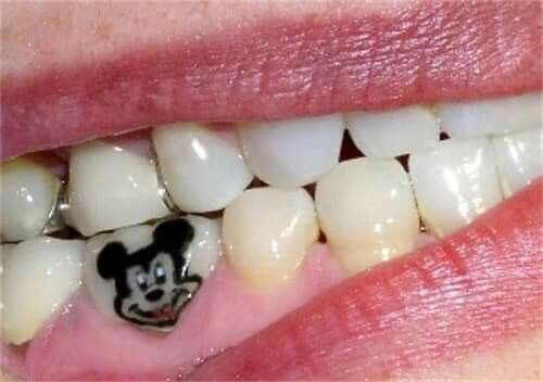 A close-up of a finished tooth tattoo featuring a custom design.
