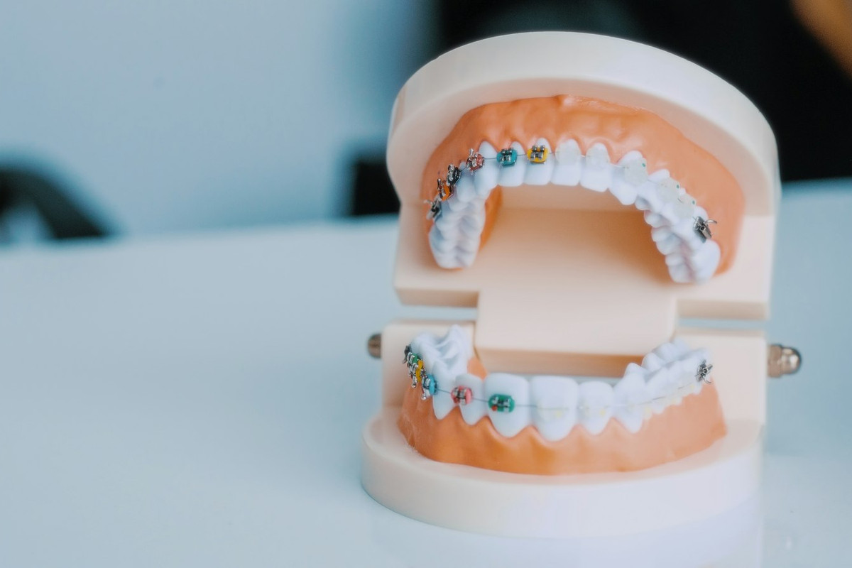 Modelo dental sobre una mesa