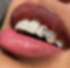 "A sparkling tooth gem highlighting a personalized and stylish dental accessory