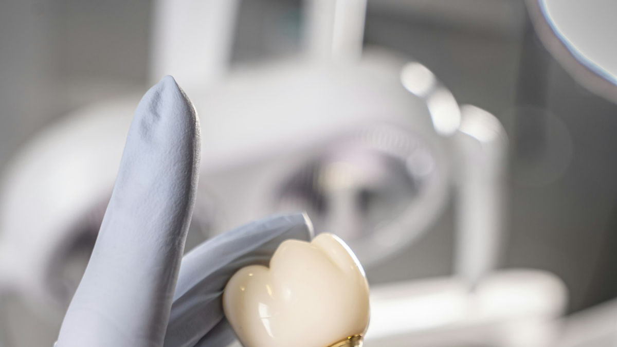 Implante dental y corona sostenidos con una mano enguantada