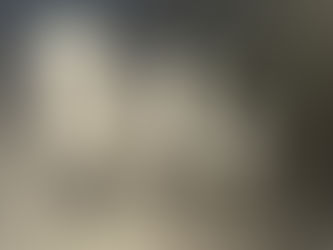 Injection Molding vs. Milling in Implant Production