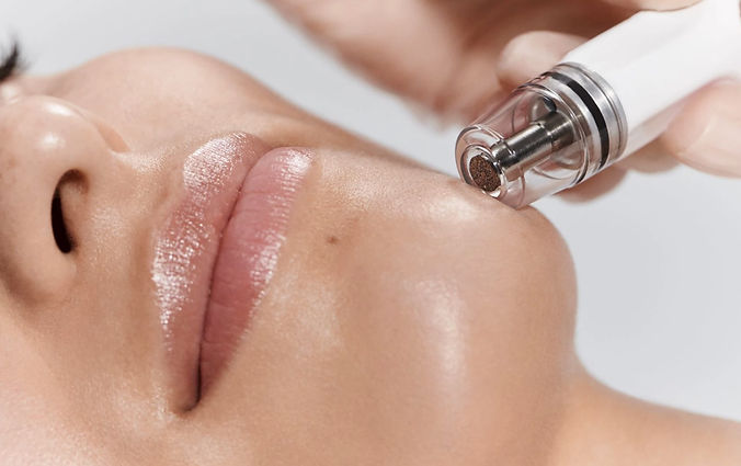 DiamondGlow in Boston.jpg