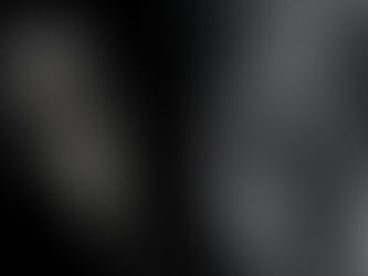 What Is Forma Skin Tightening? How It Works And Benefits