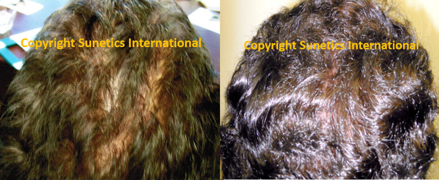 Male, 29 years old- After 12 Months