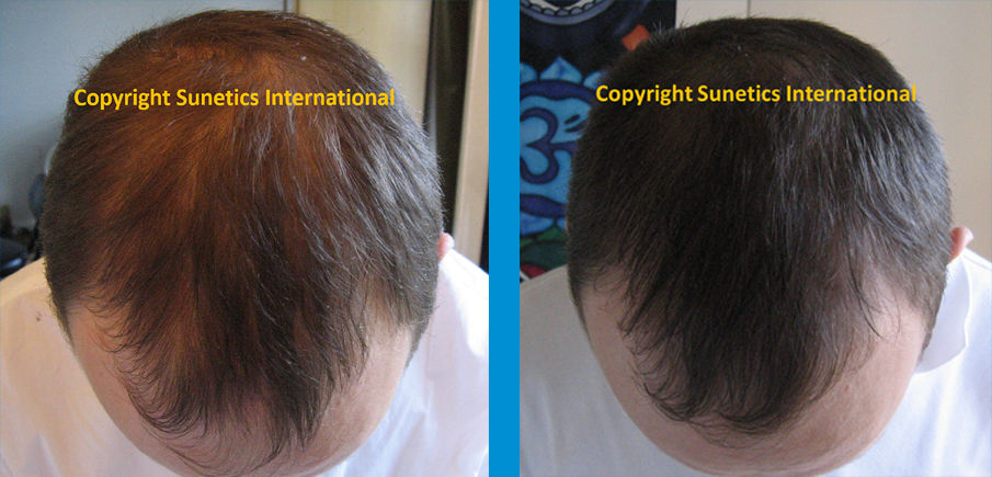 Male, 31 years old - After 4 Months