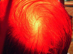 Laser dispersion | sunetics laser light
