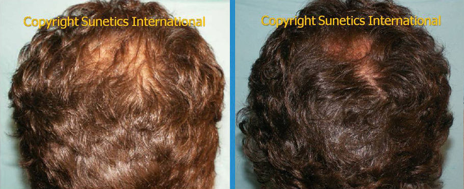 Male, 41 years old - After 3 Months