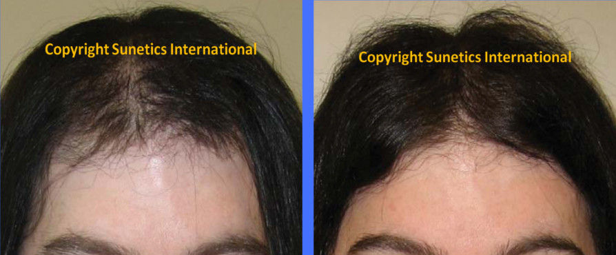 Male, 29 years old - After 6 Months