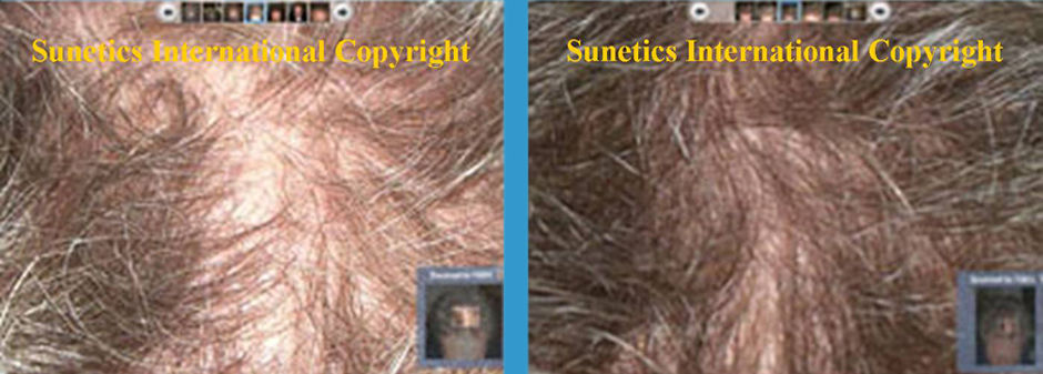 Male, 47 years old - After 4 Months