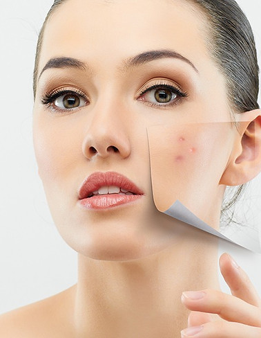 Purifying Acne Facial at Coastal Massage & Wellness