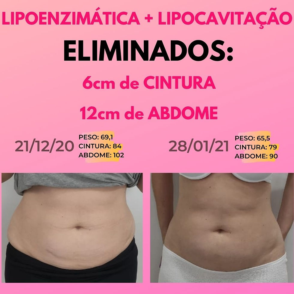 Lipoenzimática + Lipocavitação