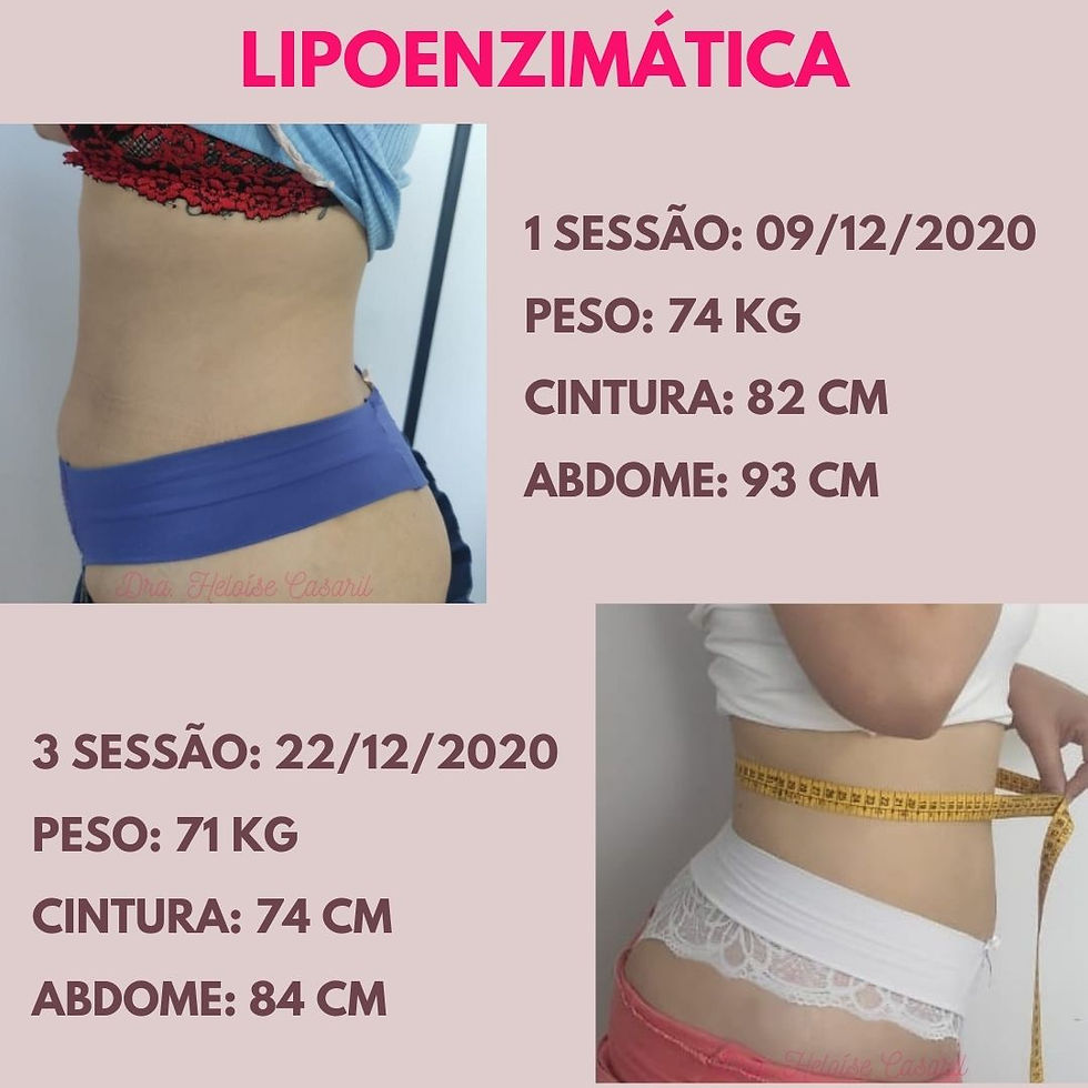 Lipoenzimática