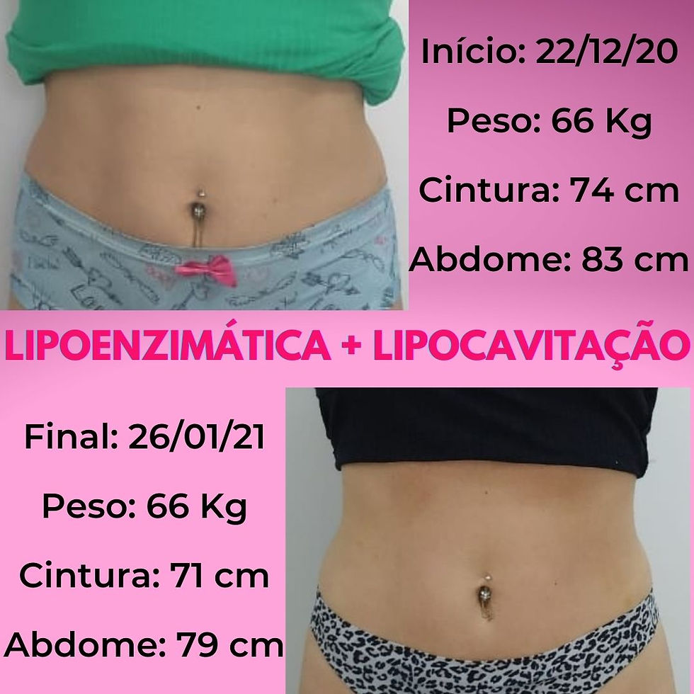 Lipoenzimática + Lipocavitação