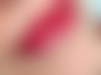 Natural Lip Blush treatment on mature lips showing soft colour and improved definition.