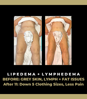 FB POSTS+ BA (72).png