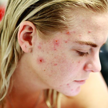 The World of Skincare
