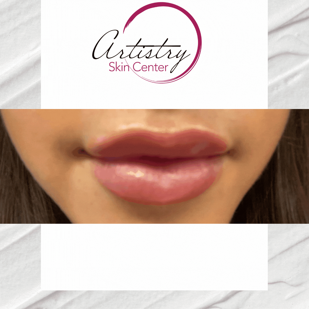 Lips Perfection