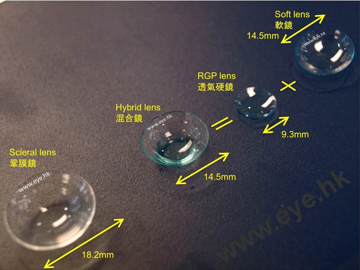 Specialty Contact Lenses Hong Kong EYE.hk scleral lens, hybrid lens
