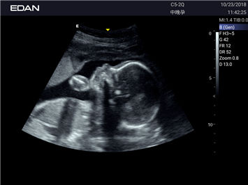 20191029045910_204381