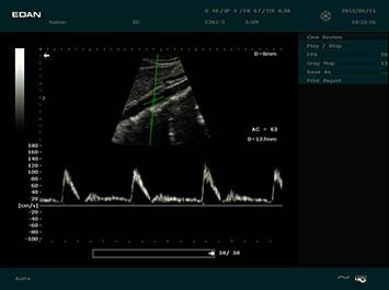 20191030085407_503197