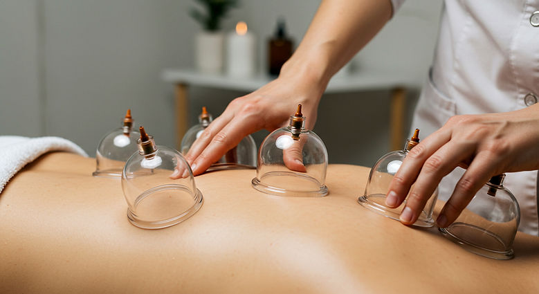 Cupping therapy