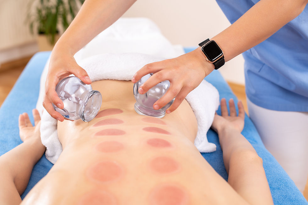 Cupping therapy
