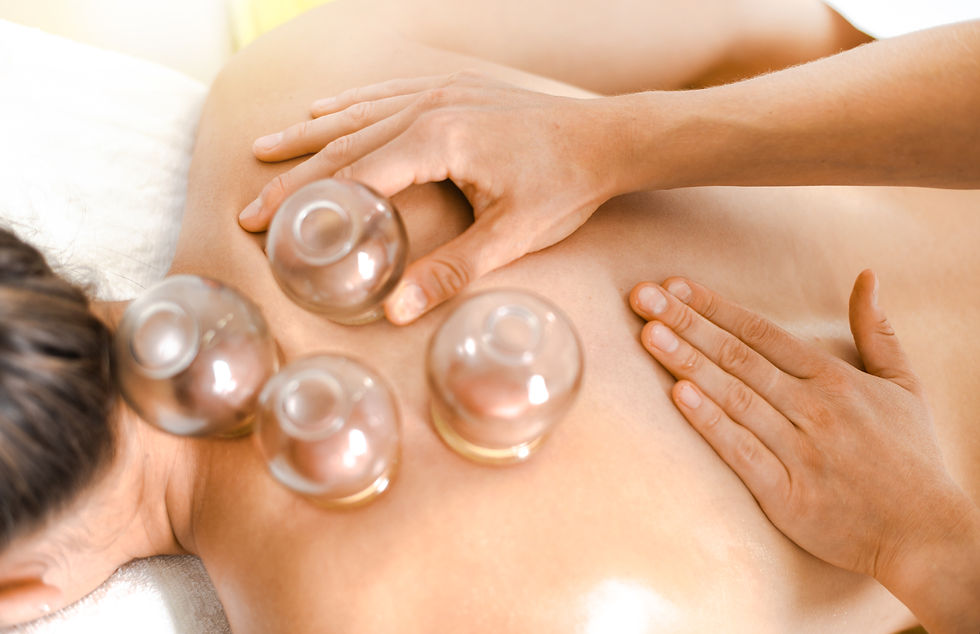 Cupping therapy
