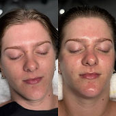 Glass Skin Facial