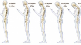 Is Your Mobile Phone Causing You Neck Pain?
